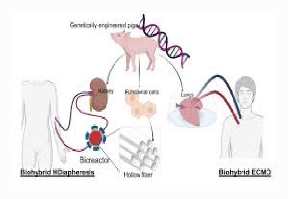 World's First Multi-Organ Pig-to-Human Xenotransplantation Performed in China